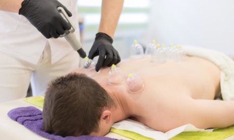 Clinical cupping therapy course