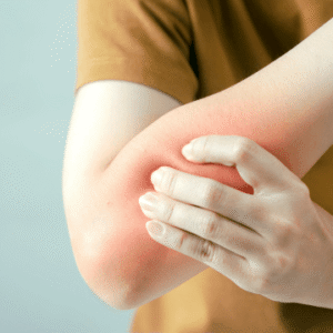 Essential Oils for Musculoskeletal Pain