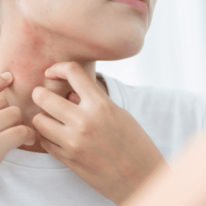 Skin Infections & Seasonal Care