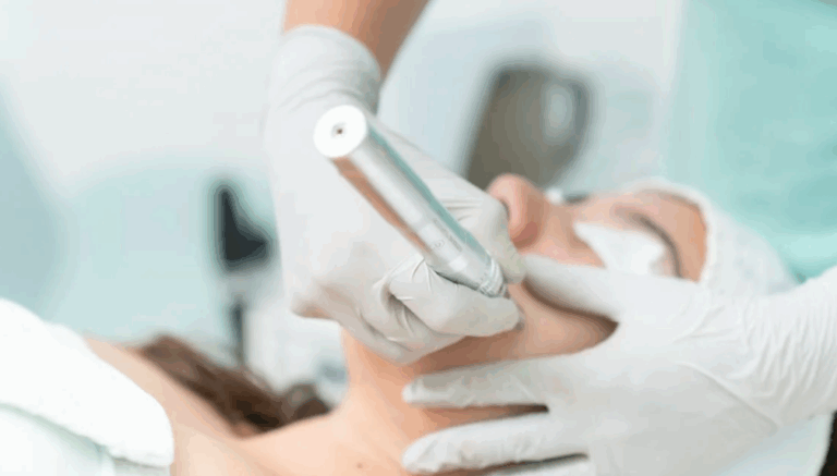 Microdermabrasion Training: What to Expect & How to Get Certified