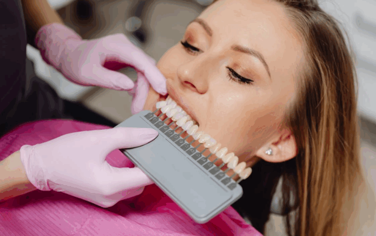 Teeth Whitening